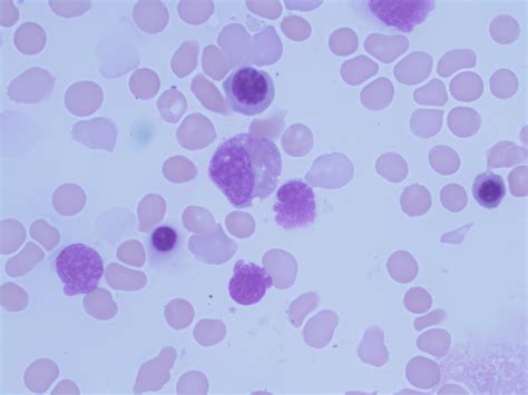Neutrophilic Myelocyte 2 Era