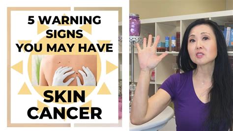 5 Warning Signs You May Have Skin Cancer Youtube