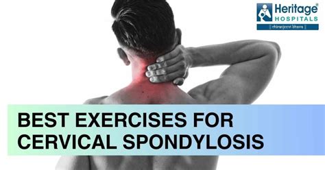 Top Best Exercises For Cervical Spondylosis To Reduce Pain