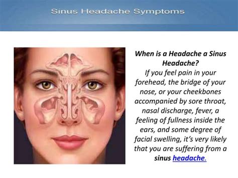 Sinus Headache Ppt