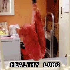 Early stage lung cancer is more commonly diagnosed incidentally while getting investigated for some unrelated problem like health if you've had a cough for more than a month then it's medically considered a chronic cough. Lung Cancer GIFs - Find & Share on GIPHY