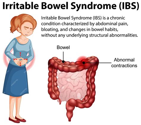 Premium Vector Irritable Bowel Syndrome Ibs Infographic