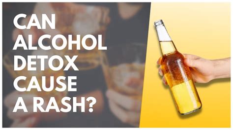 Can Alcohol Detox Cause A Rash Youtube