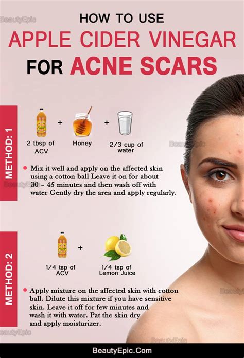 Apple cider vinegar is a completely organic and natural product containing none of the chemicals or filler ingredients found in conventional over the counter acne treatments. How to Remove Acne Scars Quickly with Apple Cider Vinegar?