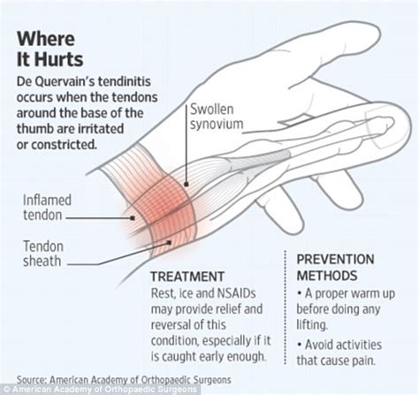 De quervain's tendinosis occurs when the tendons around the base of the thumb are irritated or constricted. Smartphone thumb is becoming a major problem in the US ...