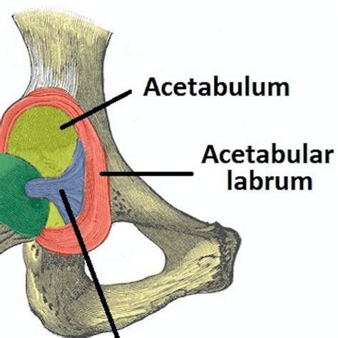 Acetabular Fracture Teachmesurgery