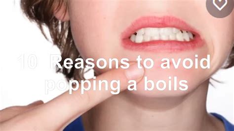 10 Reason You Should Not Pop A Boils How To Pop A Boil Best Boils