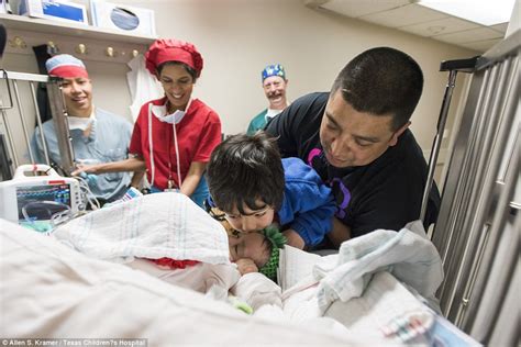 Cojoined Texas Twins Survive World First Operation To Separate Them