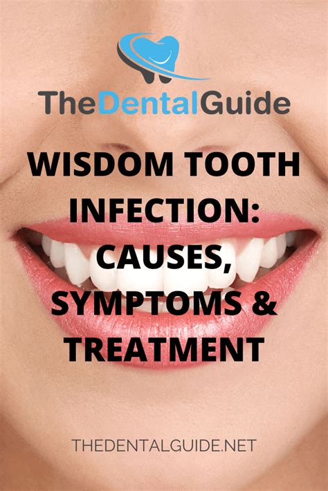 Wisdom Tooth Infection Causes Symptoms And Treatment The Dental Guide Uk