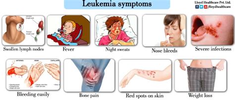 The most common symptoms include Leukemia - Blood Cancer - Drugs Can Save Your Life