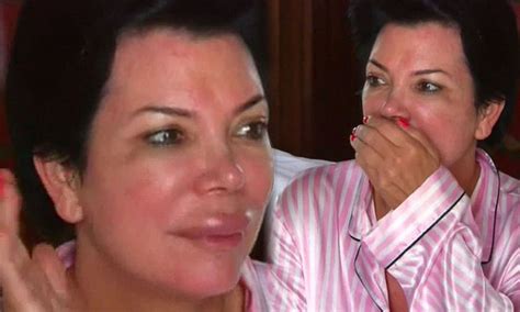 kris jenner is shocked after waking up with massive lips in the season trailer of keeping up