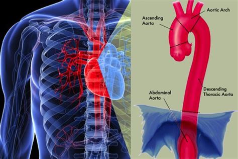 Thoracic Aortic Aneurysm Treatment In Tarzana West Hills