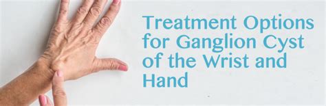 We did not find results for: Treatment Options for Ganglion Cyst of the Wrist and Hand ...