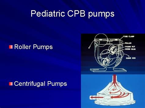 Pediatric Extracorporeal Life Support Systems And Pediatric Cardiopulmonary