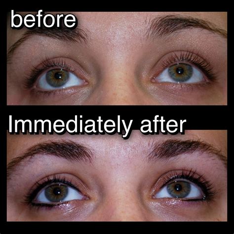 Top Eyeliner Tattoo Before And After A Bugs Life