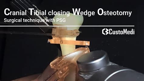 Cranial Tibial Closing Wedge Osteotomyctwo Surgical Technique With