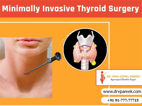 Minimally Invasive Thyroid Surgery