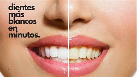 ¿por qué los dientes se vuelven amarillos? Cómo blanquear los dientes en minutos, fácil y en casa ...