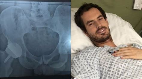 Andy Murray Undergoes Hip Surgery In Bid To Prolong Tennis Career