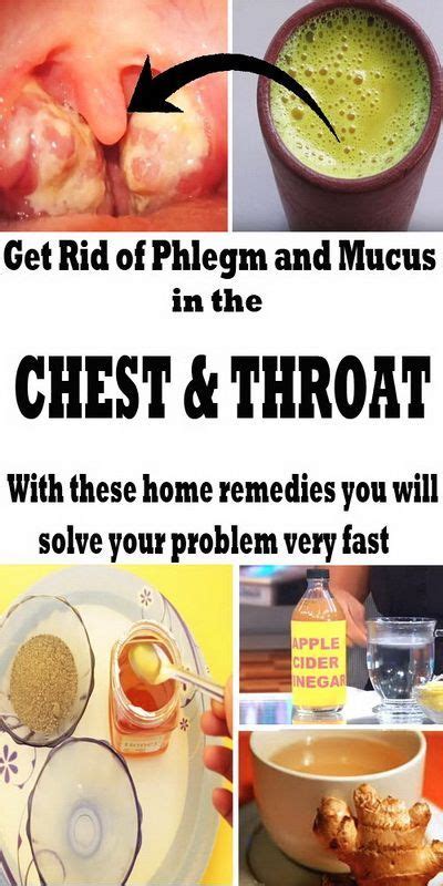 Home Remedies For Phlegm Bronchitis Contagious
