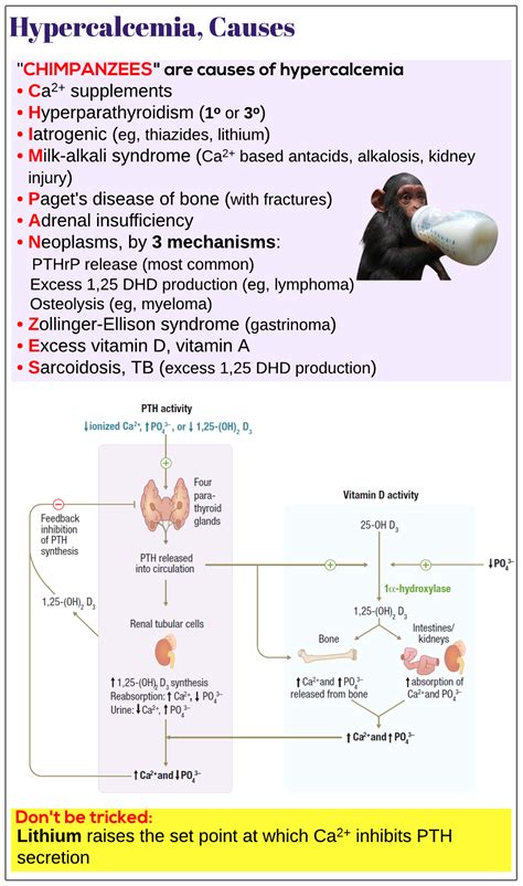 Hypercalcemia Causes Medicine Keys For Mrcps