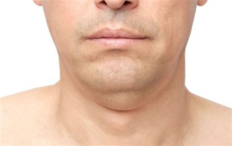 12 Ways To Get Rid Of Neck Fat Tendig