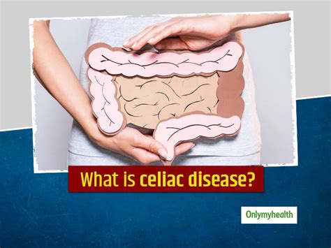 Celiac Disease Symptoms Causes Diagnosis Risk Factors Diet And