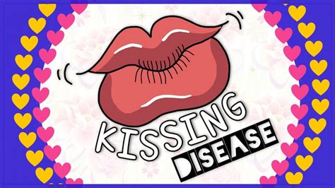 Infectious Mononucleosis Kissing Disease Diagnosis Clinical Feature