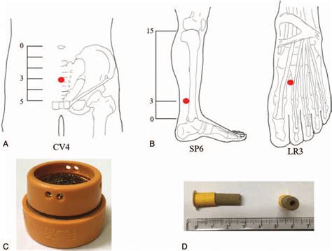 Location Of Acupuncture Points And Type Of Moxibustion Used A