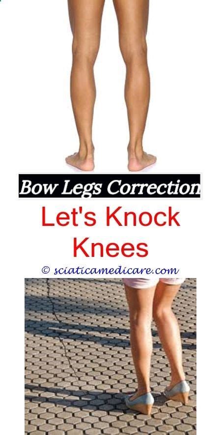 Permanent Remedy For Bow Legs Thigh Bowwhat Makes A Person Bow