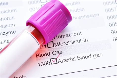 What Is An Arterial Blood Gases Test And What Does It Tell Your Doctor