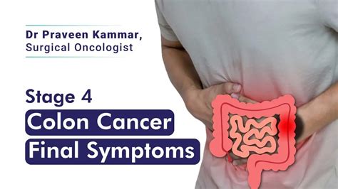 How To Spot The Last Symptoms Of Colon Cancer Dr Praveen Kammar