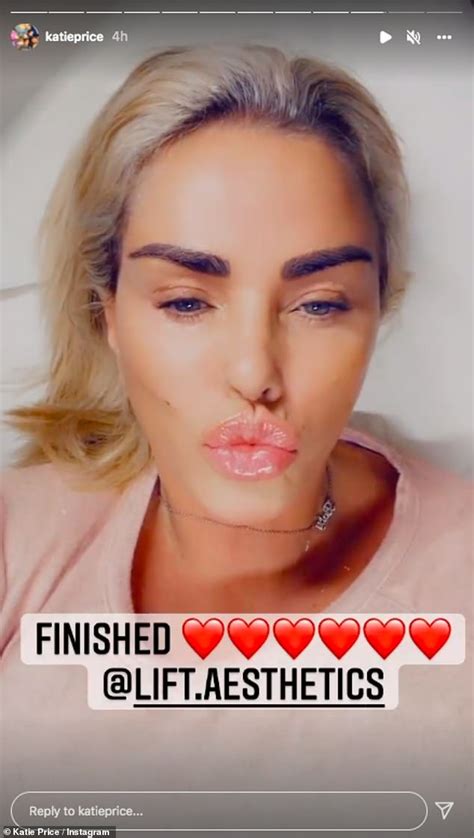 Katie Price Shows Off Her Plump Pout After Getting Lip Filler Daily