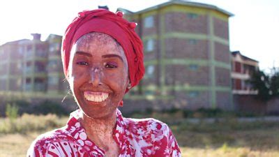 Leishmaniasis Tropical Skin Disease Afflicts Kenyan Communities BBC News