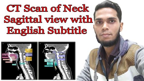 Ct Scan Of Neck Sagittal Anatomy Youtube