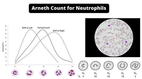 Arneth Count For Neutrophils Principle Procedure