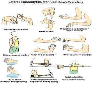 Tennis elbow will not heal if you continue to exacerbate it. Healthy and Fit: July 2009