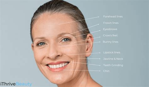 The 12 Best Areas Of The Face For Cosmetic Botox Treatment Ithrivebeauty