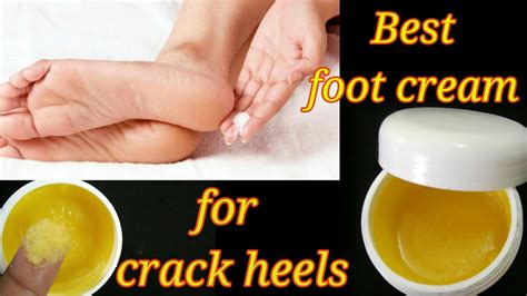Diy Homemade Best Foot Cream For Cracked Heels 👌 Youtube