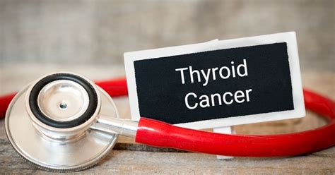 10 Signs Of Thyroid Cancer Facty Health