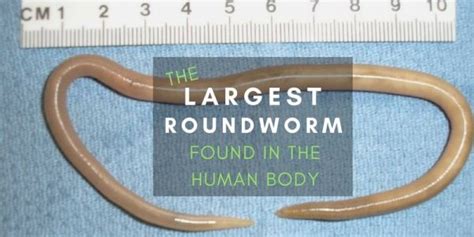 Ascaris The Largest Roundworm Are There Worms Living In Your Gut
