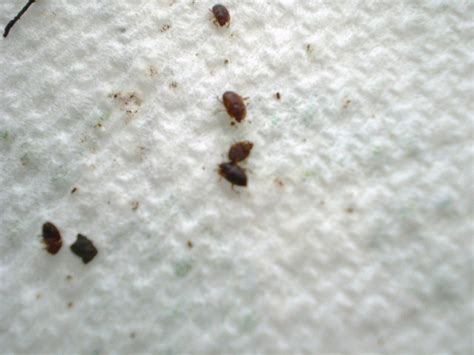 Check spelling or type a new query. Little Small Bugs In Bedroom | Psoriasisguru.com