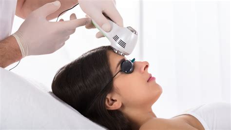 Widows Peak And Laser Hair Removal To Get Rid Of It