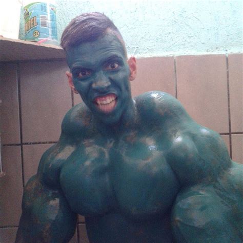 ¿todo Vale Así Lucía El Hulk Real Tras Inyectarse Una Mezcla Letal En Sus Brazos Fotos Rt
