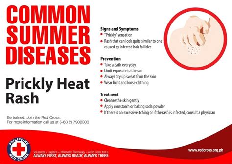 Prickly Heat Symptoms Causes Types And Associated Risk Factors