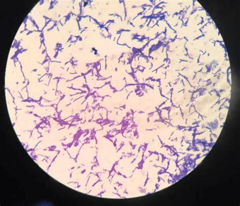 Result Of Gram Staining Under Light Microscope With Magnification