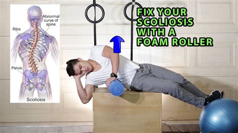 Fix Your Scoliosis With A Foam Roller Scroths Method Youtube