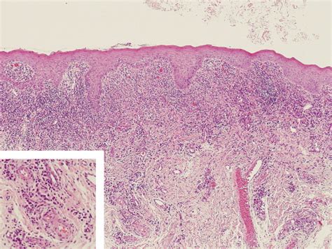 Histological Features Of The Buccal Mucosa The Basal Region Of The