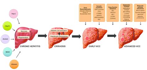 Pathogenesis Of Hepatocellular Carcinoma Chronic Exposure Of The Liver