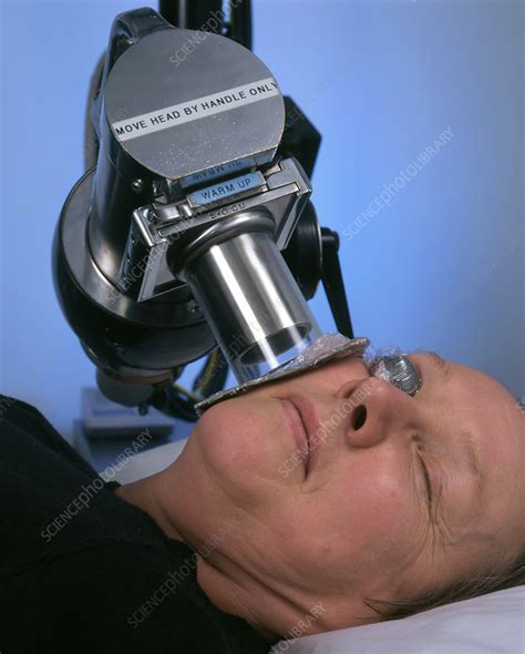 Radiotherapy Treatment Of Skin Cancer On Cheek Stock Image M705